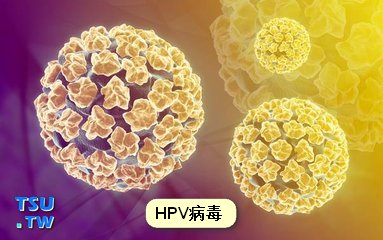 割包皮手术能预防人乳头瘤病毒HPV感染