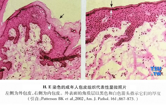 H.E染色的成年人包皮组织代表性显微照片