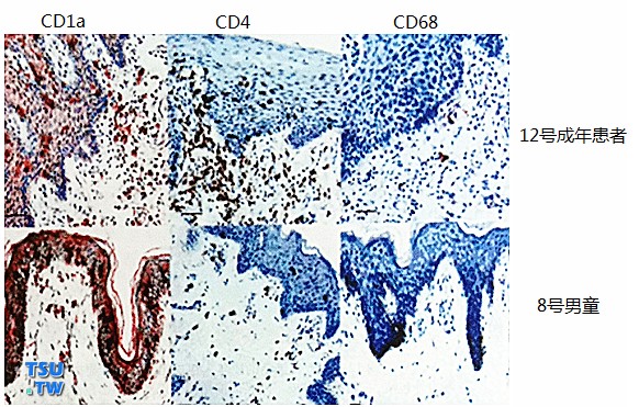 男性包皮感染艾滋病病毒的组织学和分子细胞生物学基础