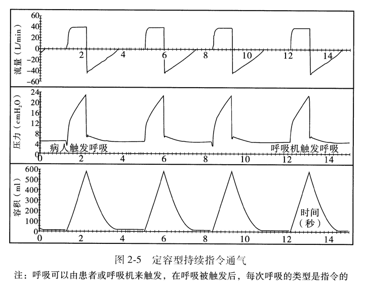 定容型持续指令通气