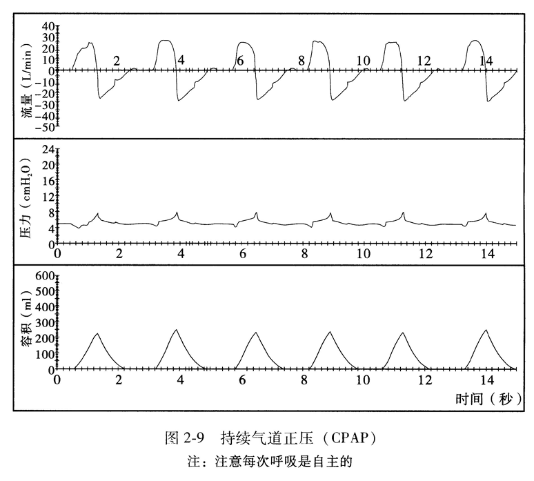 持续气道正压(CPAP)