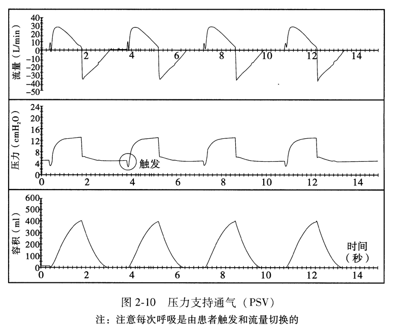 压力支持通气( PSV)