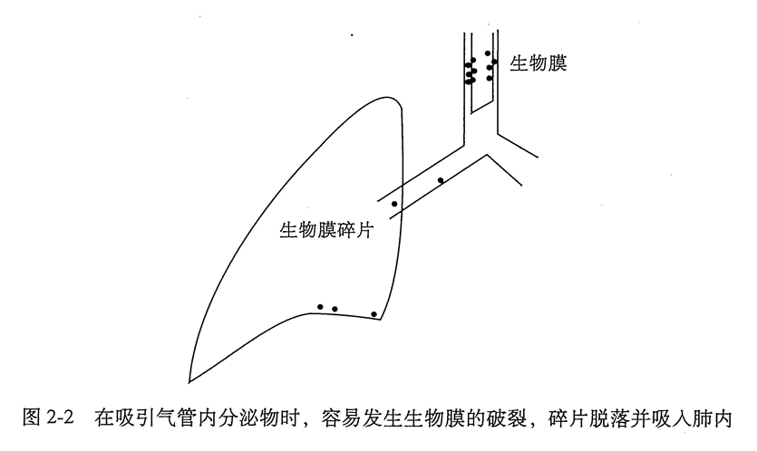 在吸引气管内分泌物时，容易发生生物膜的破裂，碎片脱落并吸入肺内