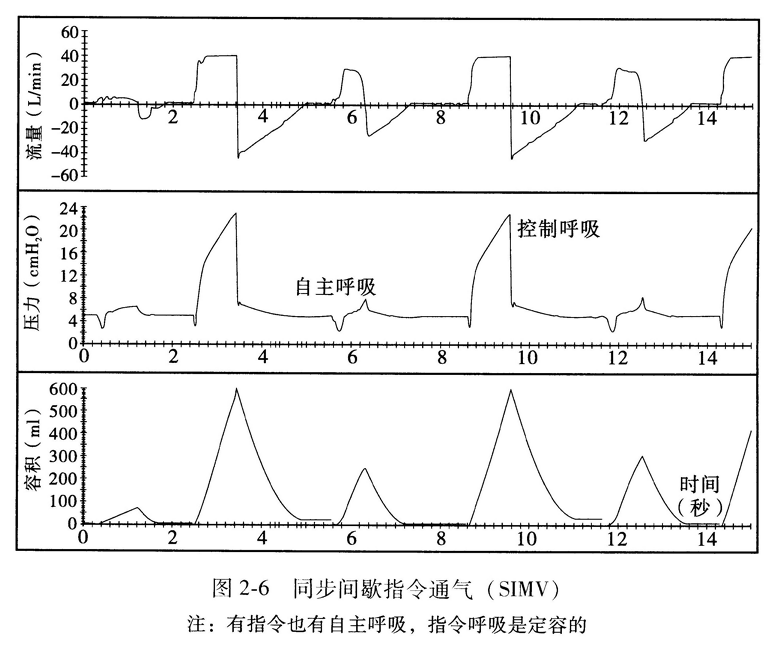 同步间歇指令通气( SIMV)