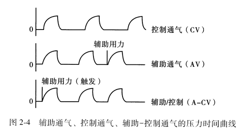 辅助通气、控制通气、辅助一控制通气的压力时问』|ll线