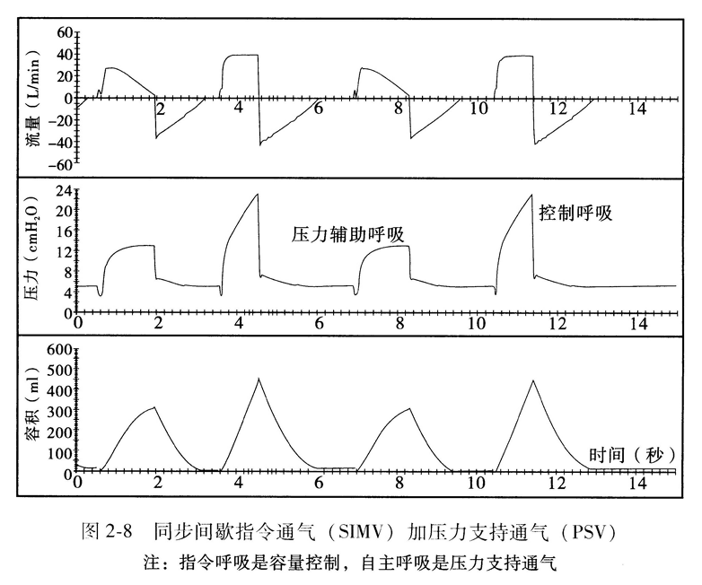 同步间歇指令通气(SIMV)加压力支持通气(PSV)