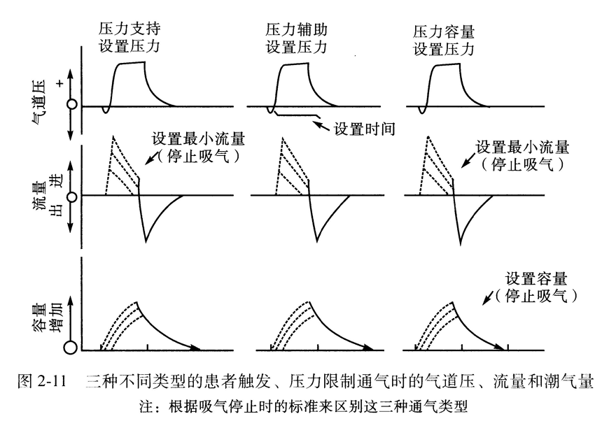 三种不同类型的患者触发、压力限制通气时的气道压、流量和潮气量