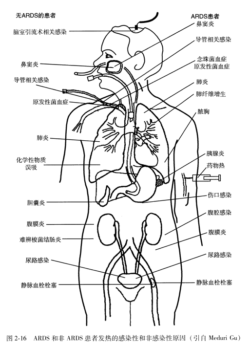 ARDS和非ARDS患者发热的感染性和非感染性原因