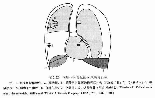 气压伤时常见的X线胸片