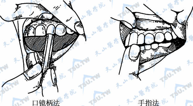 口腔及颌面部常用检查