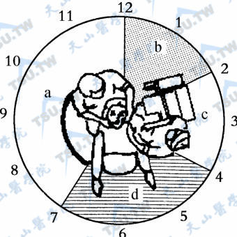四手操作医、护、患位置关系（以惯用右手的医师为例）