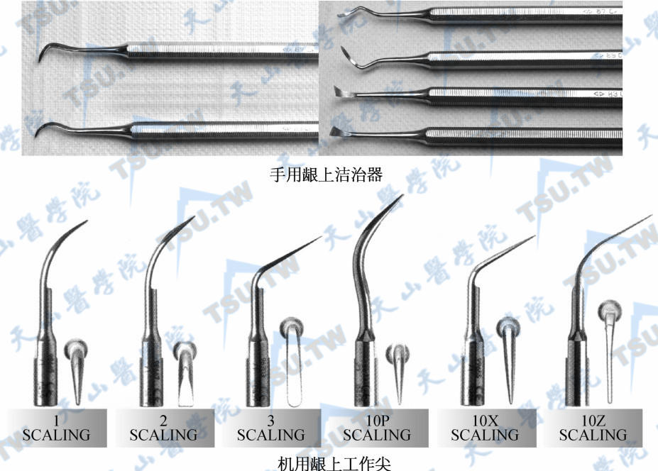 牙周洁治器