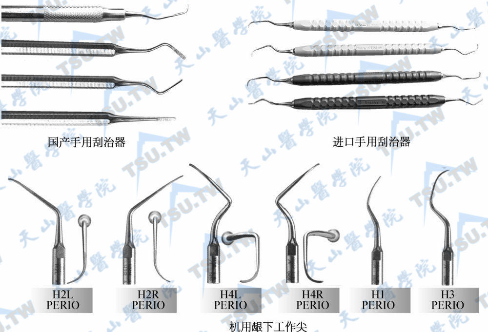 牙周刮治器