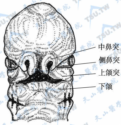 中鼻突与上颌图融合示意图