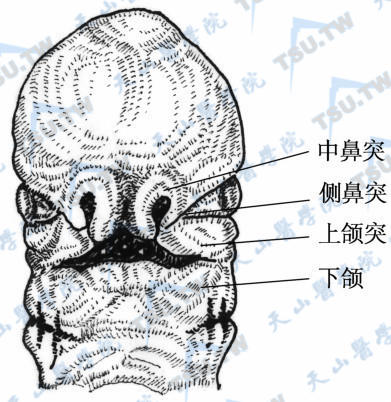 先天性唇裂、腭裂的发病机制