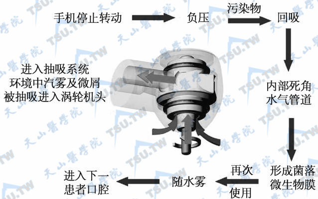 牙科手机内部结构图图片