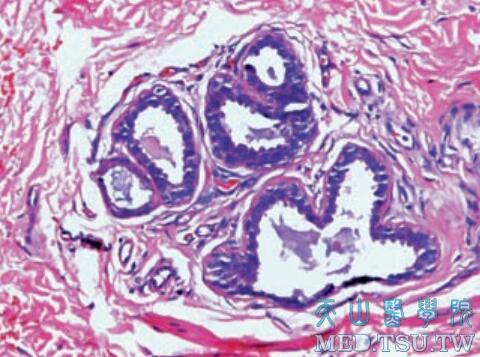 顶泌汗腺（又称大汗腺）