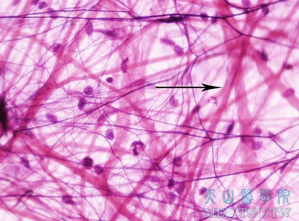 疏松结缔组织 胶原纤维