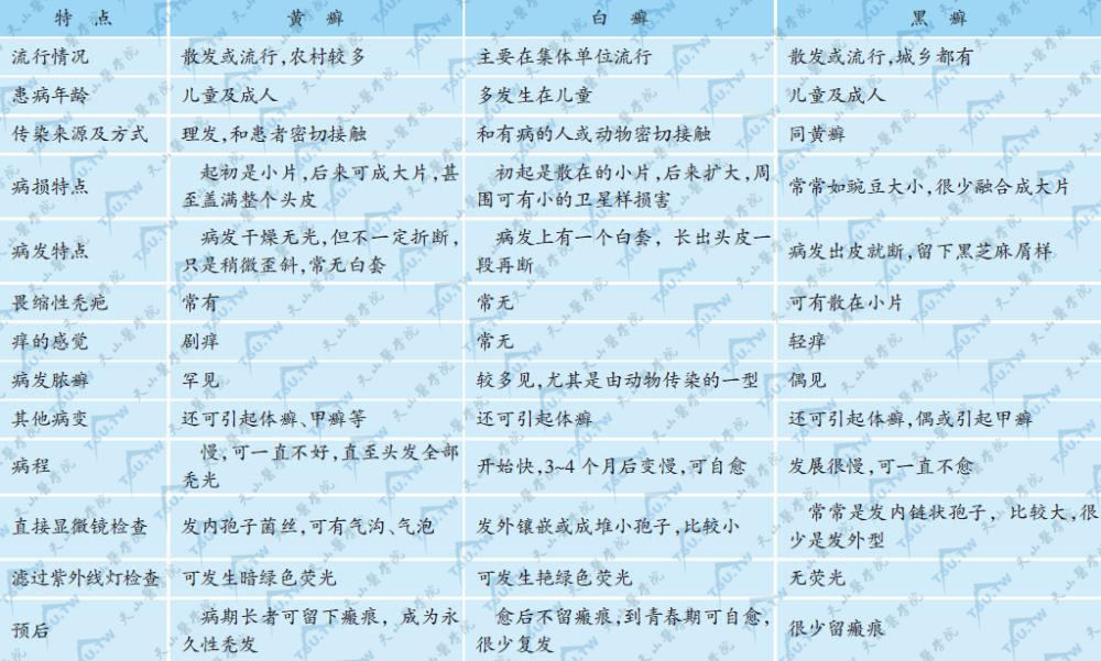 黄癣、白癣、黑癣三种头癣的主要特点