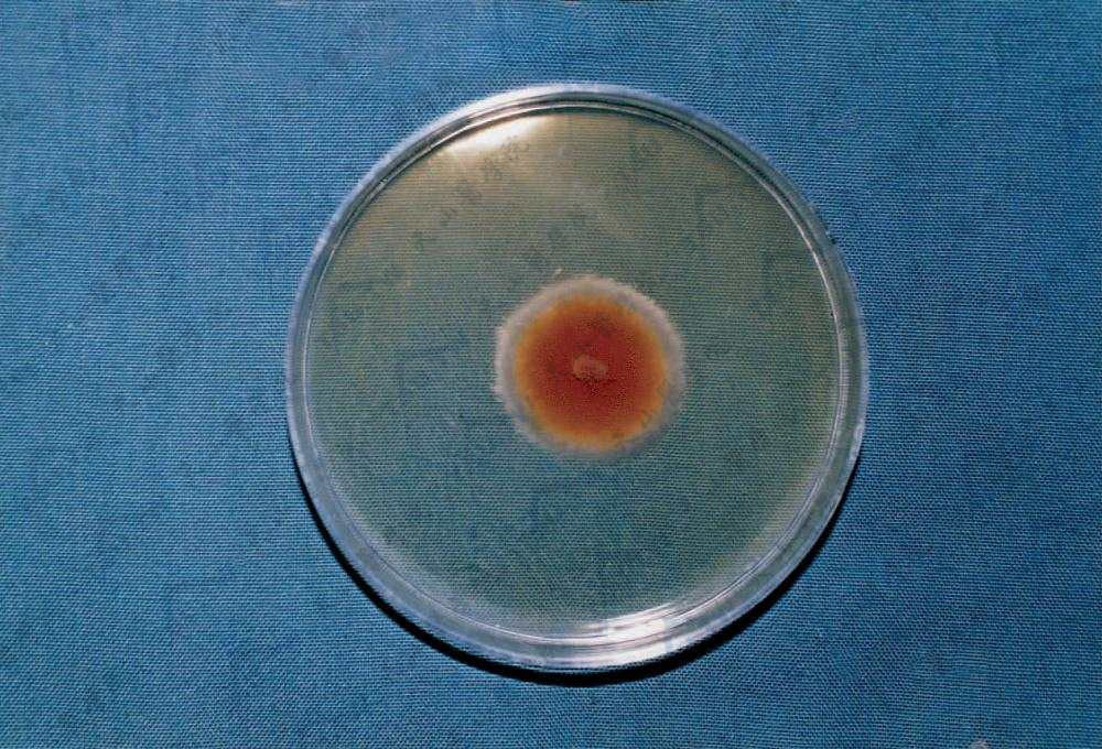 交链链格孢26℃在SDA上的菌落形态（中国医学科学院皮肢病研究所　刘维达提供）