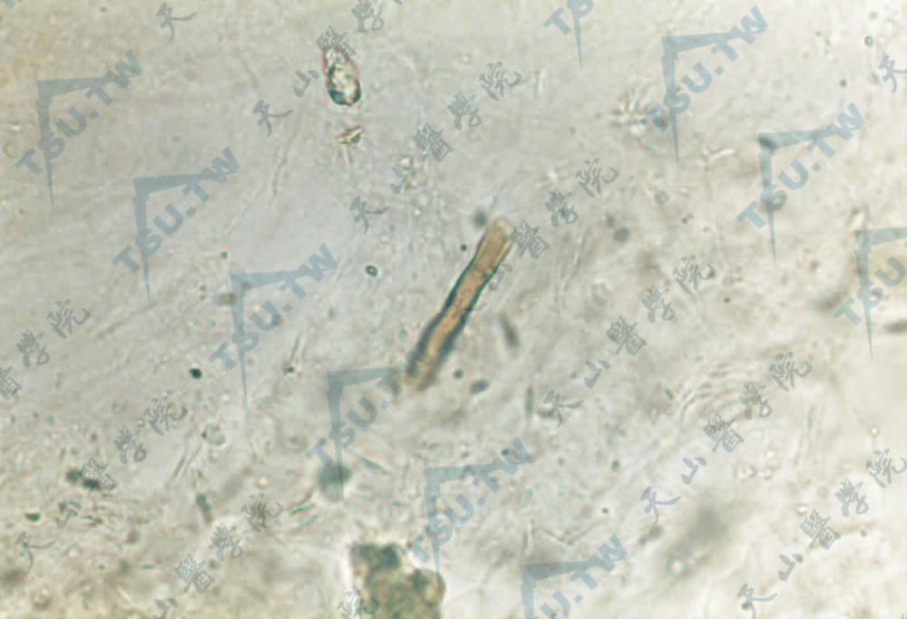 交链链格孢26℃在SDA上显微镜下结构特征