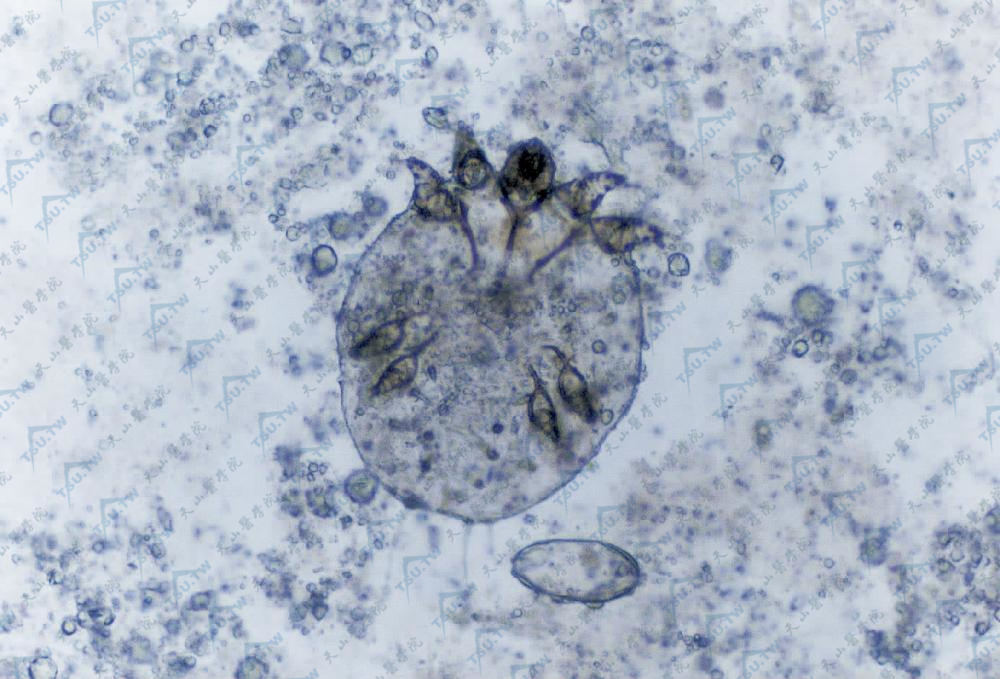 直接镜检疥虫及虫卵