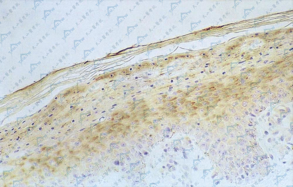 表皮浅层着色阳性（抗高糖素染色×200）