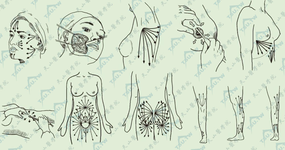 各部位吸脂的路径图
