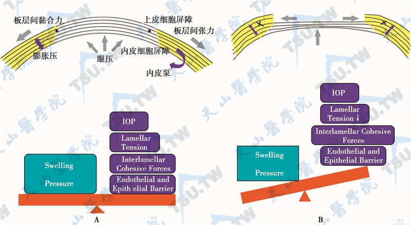 .角膜屈光手术（PRK等）进行前部中央基质浅层切削后角膜力学改变示意图