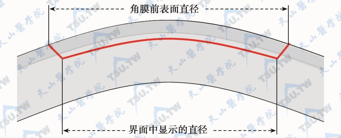 角膜cap的实际直径与角膜曲率有关