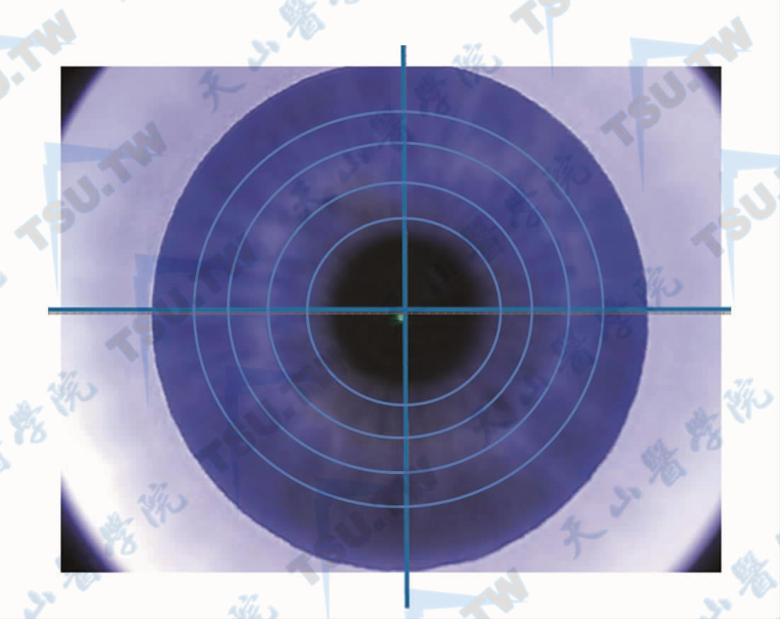 医师的目镜上十字线
