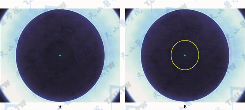 A.让患者注视上方的绿点；B.术者调节瞳孔中心将其与注视点中心重合后负压吸引扫描