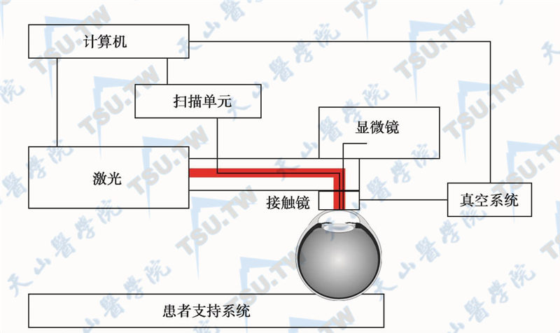 VisuMax飞秒激光手术系统工作示意图