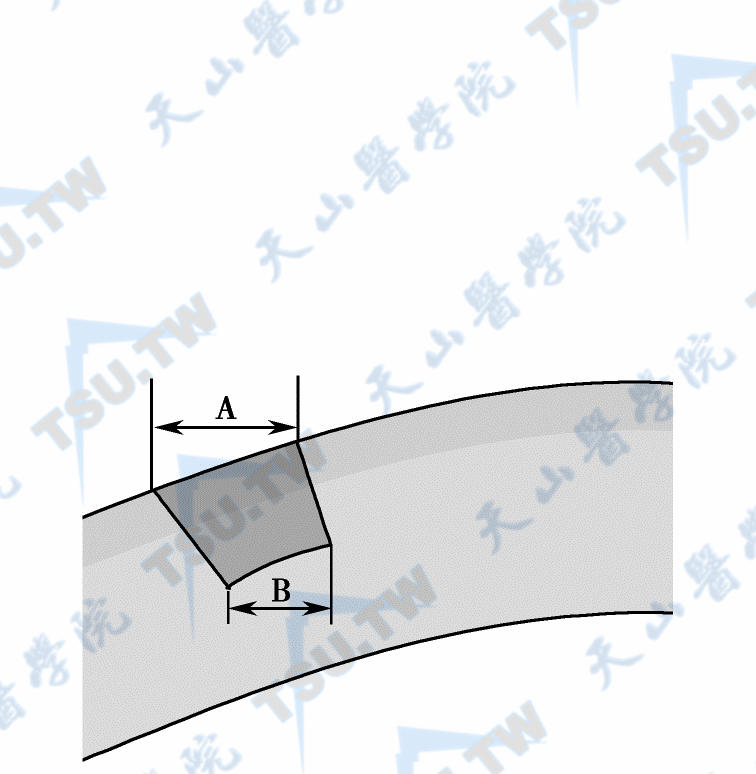 软件中选择的值（B）与角膜表面上的最终切口（A），通常A＞B