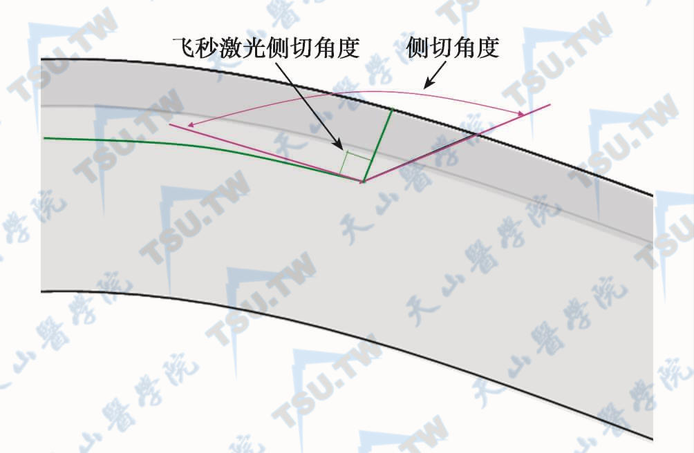 侧切角