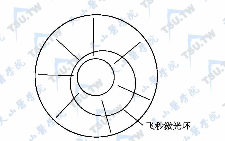 飞秒激光环设计