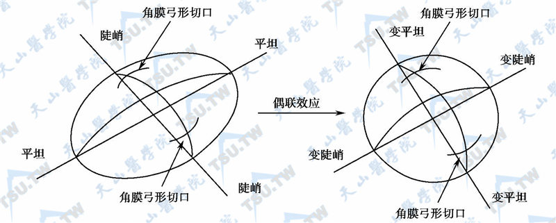 偶联效应示意图