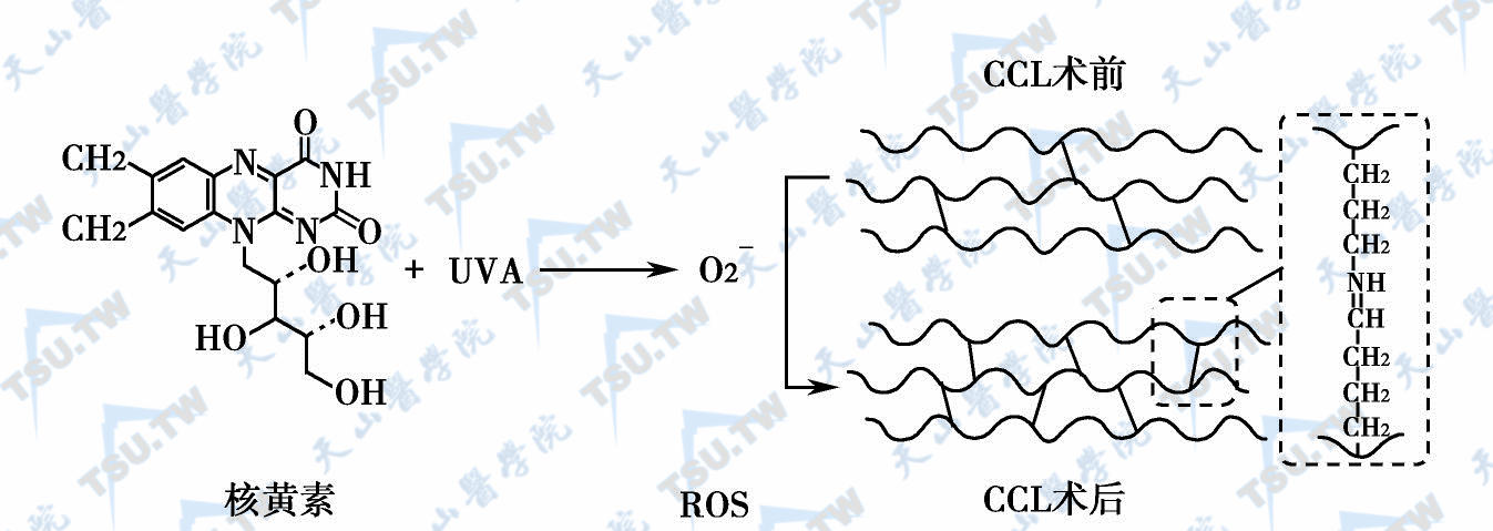紫外线A-核黄素胶原交联机制