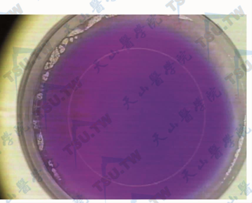 飞秒激光切削圆锥角膜患者角膜后，可以角膜切口为规则圆形，瞳孔位于切削环中央