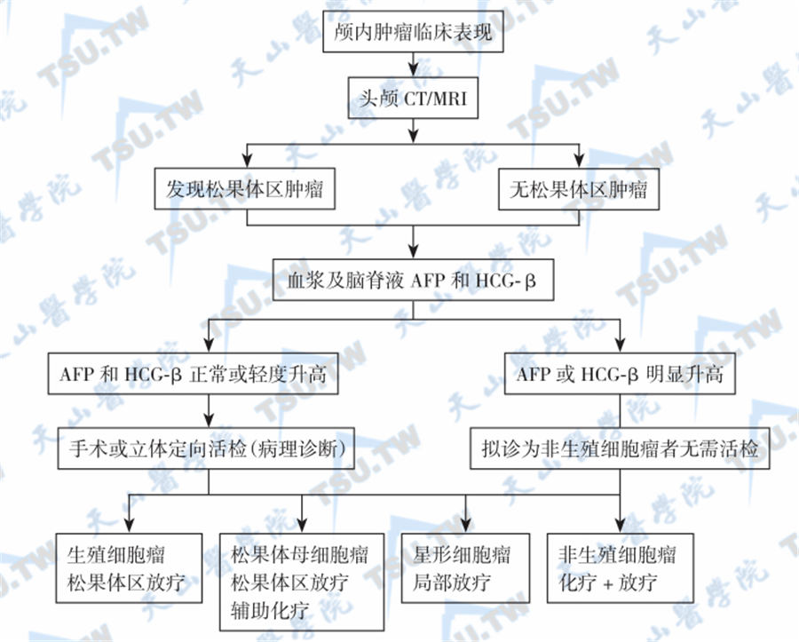 松果腺区肿瘤