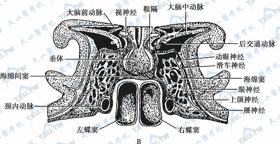 垂体柄矢状解剖图图片