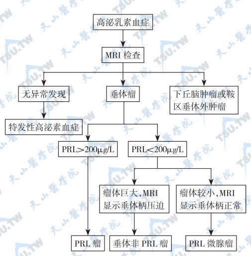 泌乳素瘤PRL的辅助检查和诊断依据