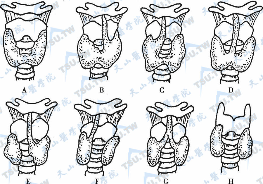 甲状腺的常见形态与变异