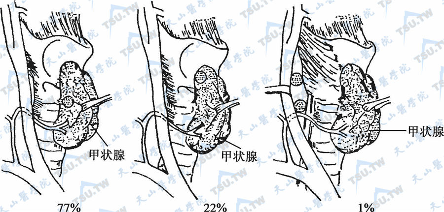   上甲状旁腺的分布图