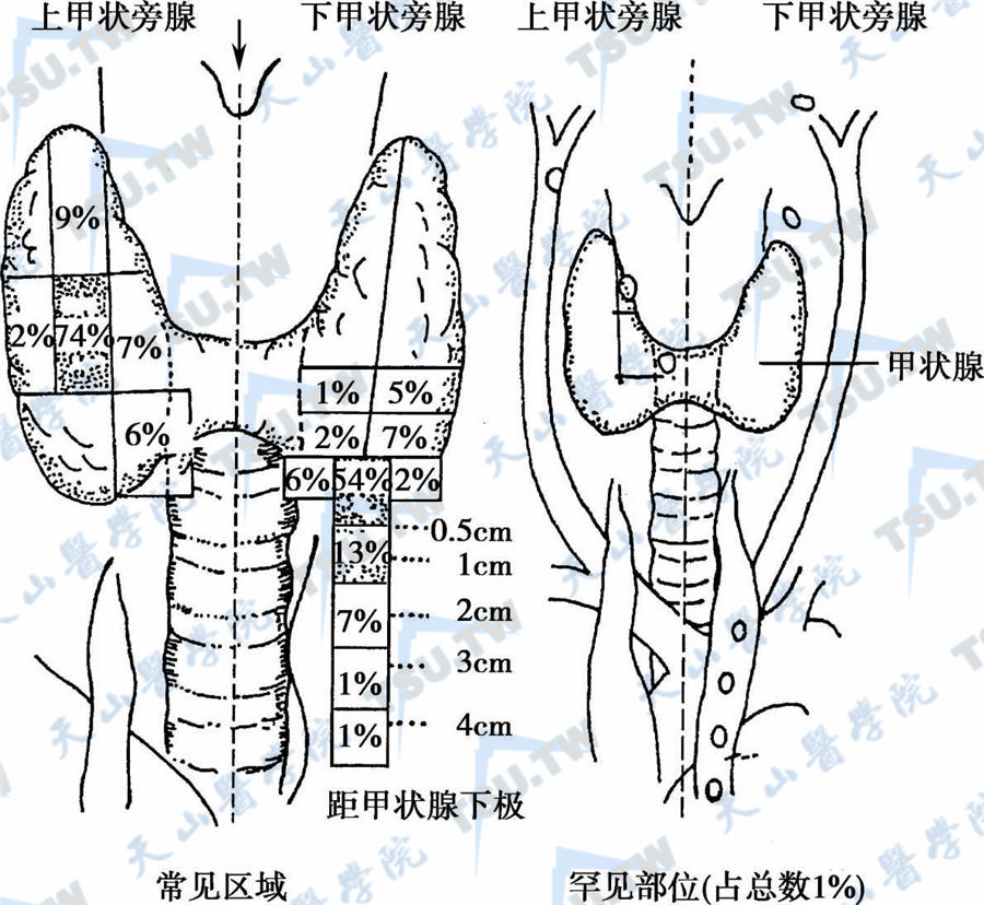上、下甲状旁腺的分布图（正面观）