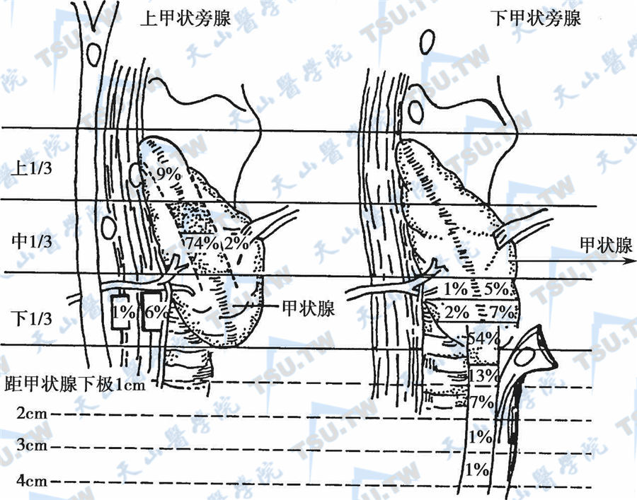 上、下甲状旁腺的分布图（侧面观）