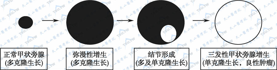  三发性甲旁亢的病理变化过程