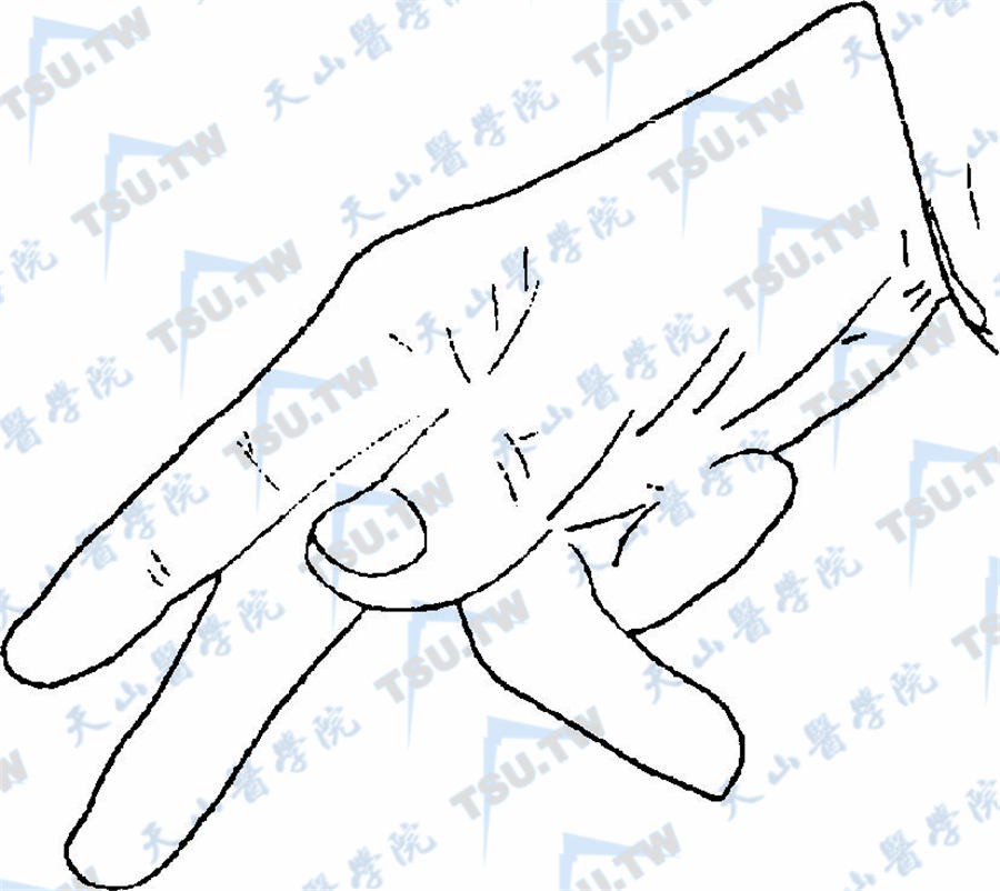  阳性低血钙性束臂征（Trousseu征）