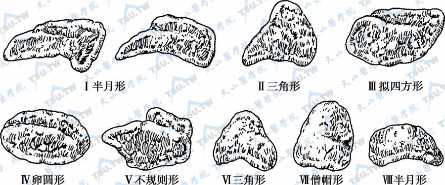  肾上腺的形态变异