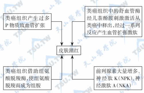 认识类癌瘤（类癌综合征）及其病因